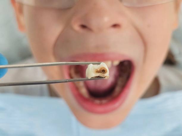 Best Emergency Treatment for Oral Infections in Carnesville, GA
